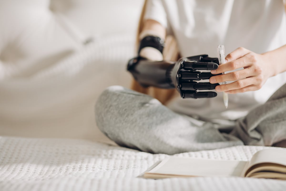 bionic hand